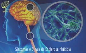 Sintomas e Sinais da Esclerose Múltipla