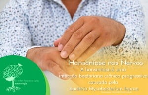 Saiba Mais sobre a Hanseníase nos Nervos