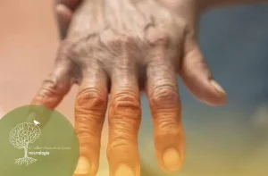 O que Pode Causar Neuropatia Periférica?