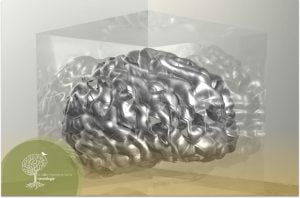 Hipertensão Intracraniana Idiopática – Saiba Mais